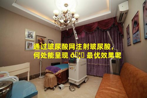 通过玻尿酸网注射玻尿酸，何处能呈现 🦊 最优效果呢